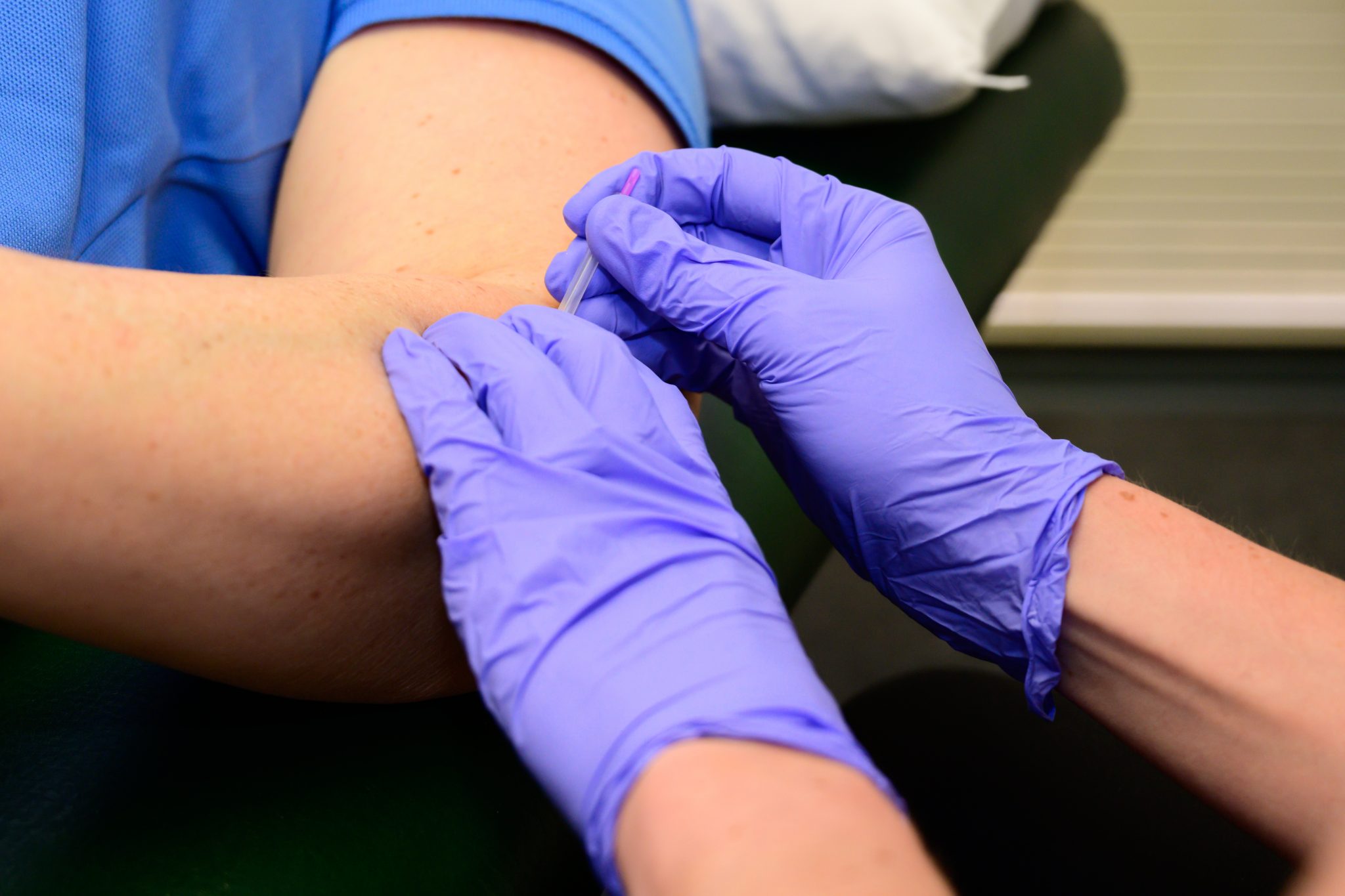 dry-needling-cimt
